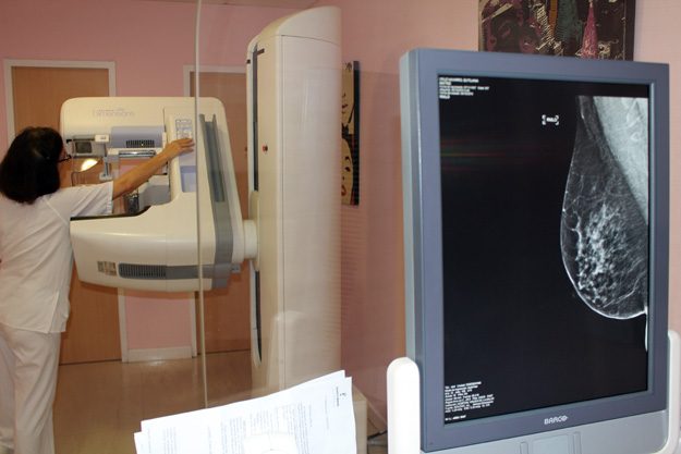 deteccion-precoz-de-cancer-de-mama-mamografo-hospital-de-toledo
